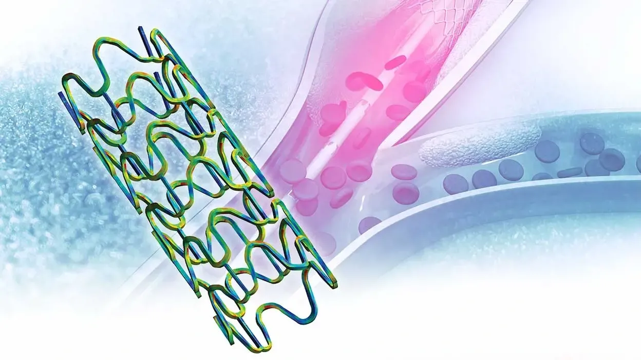 Cardiovascular stent inside an artery, simulation render