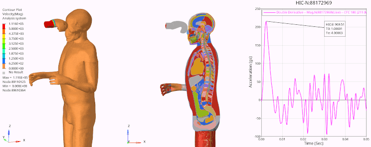 Radioss animation of a jab to the face of a THUMS human model, with a section view and HIC above 960